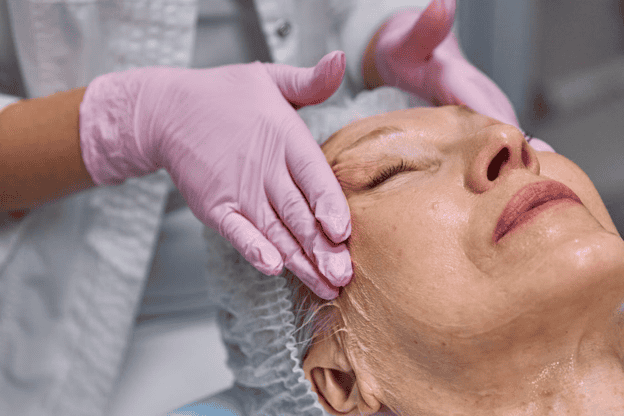 Endoscopic Facelift
